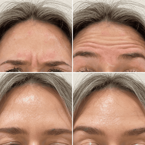 Lift, Tighten & Brighter - Celimax Retinal Glow boosting Cream