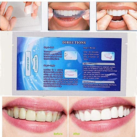 Teeth Whitening Strips (Pack of 28)
