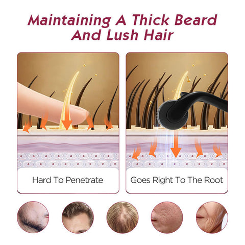 Hair Growth Derma Roller