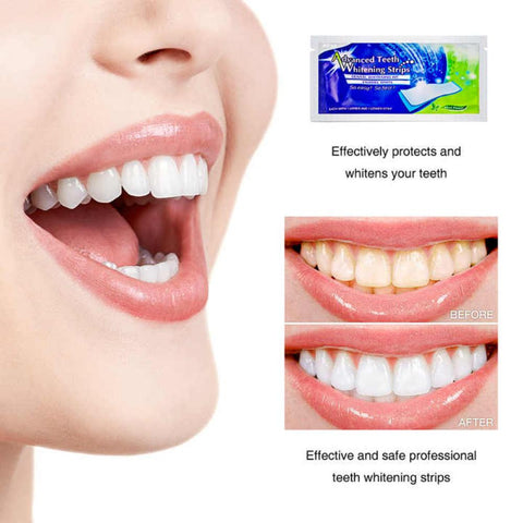 Teeth Whitening Strips (Pack of 28)