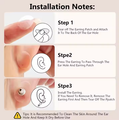 Earring Support Patches