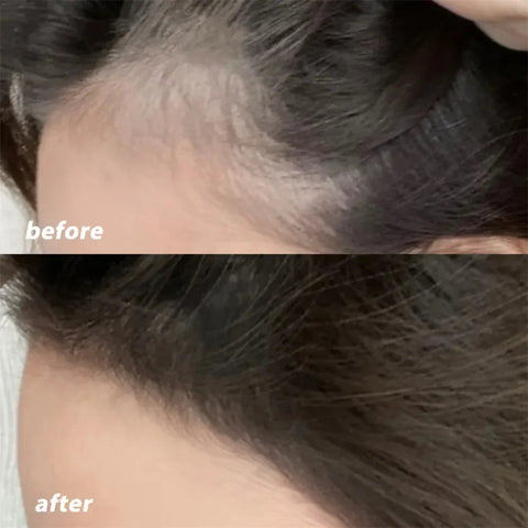 Waterproof Root Cover Up Cushion