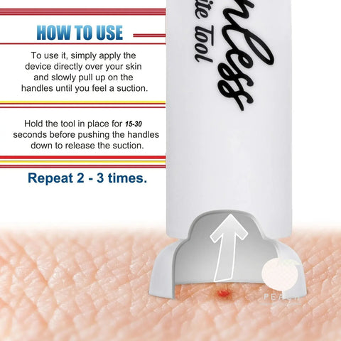 Insect Bite Relief Suction Tool