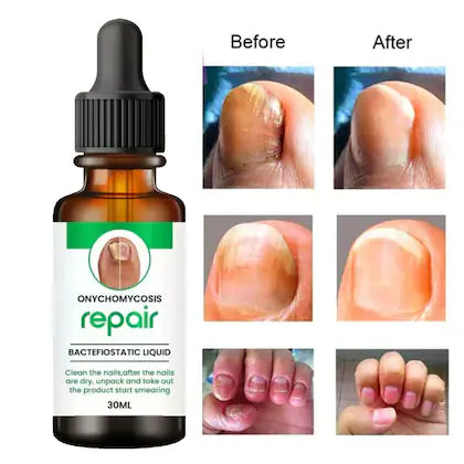 Nail Serum for Repair & Growth